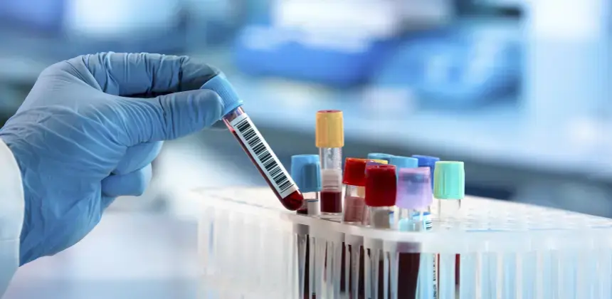 Mano con guante sosteniendo tubo de ensayo con muestra de sangre junto a otros tubos en laboratorio